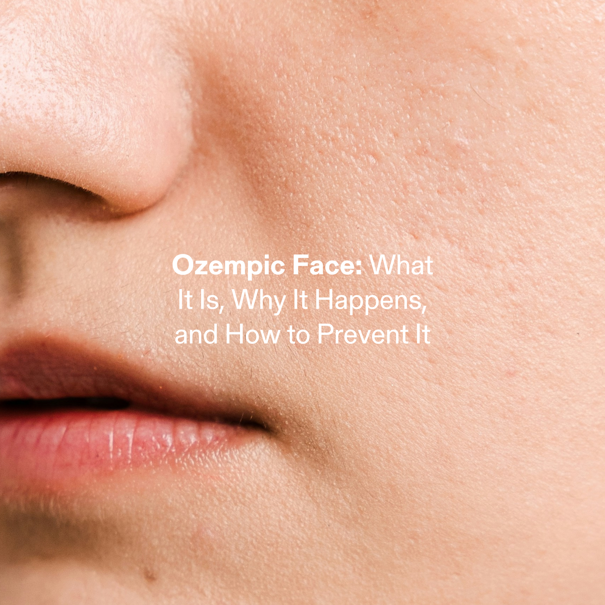 Ozempic Face: Causes, Prevention & Natural Alternatives –