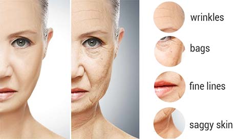 10 Signs of Aging: Causes & Treatments